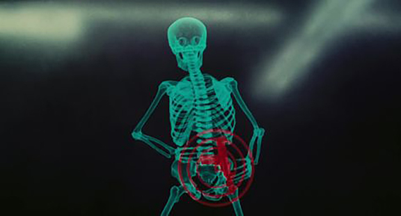 Total-Recall-Skeleton.jpg